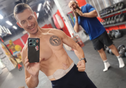 Cvičení pro stomiky s trenérem